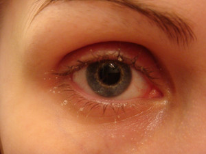 Wheee droplets. ♪ - Eyebrow Vitamin E Oil Scar remover